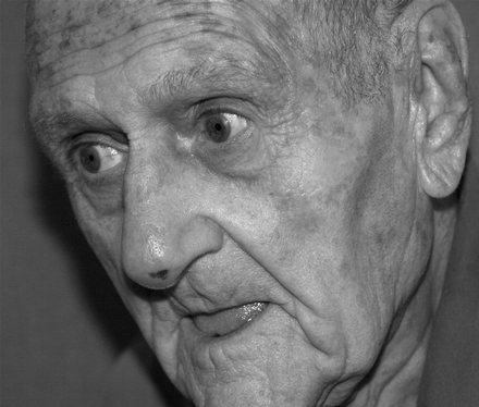 Alzheimer-kór