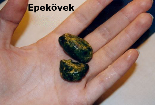 epekövek