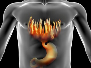 reflux
